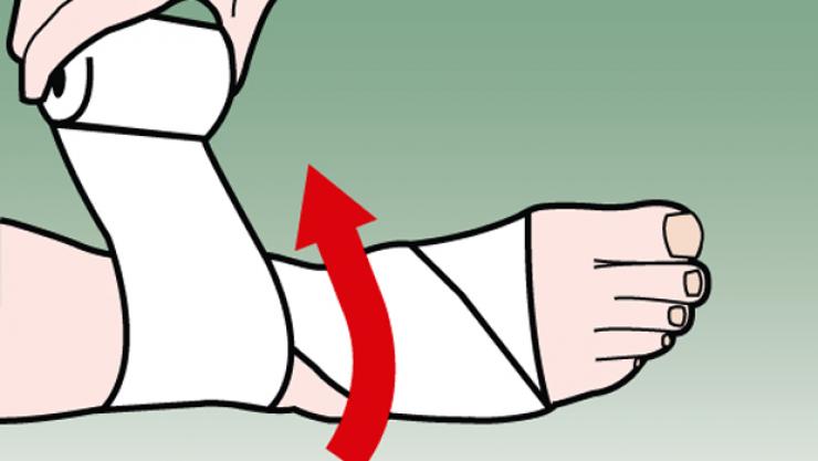 Hướng dẫn hỗ trợ bảo vệ cổ chân với băng cuốn thể thao
